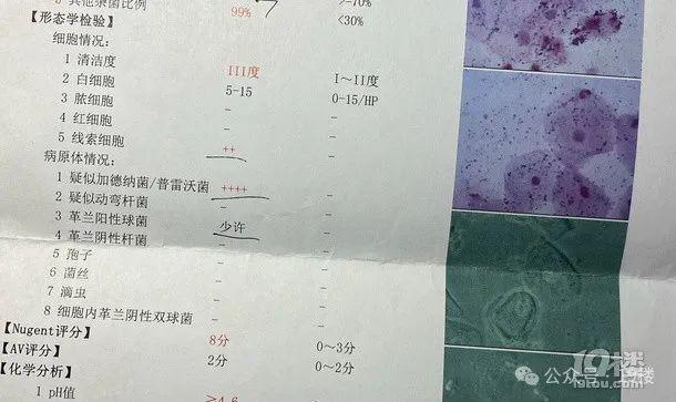 Kaiyun“痒到睡不着还有灼热感！”销量破百万的卫生用品杭州姑娘却因它直奔医院(图2)